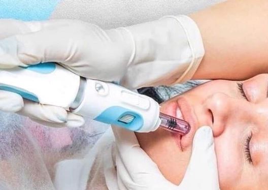 Exciting New Treatment To Smooth Wrinkles & Plump Lips